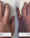 Recenzia dermálneho krému Dermal R. Do dvoch dní som cítiľ úľavu