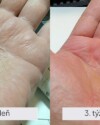 Recenzia dermálneho krému Dermal R. Vyjadrujem veľkú spokojnosť