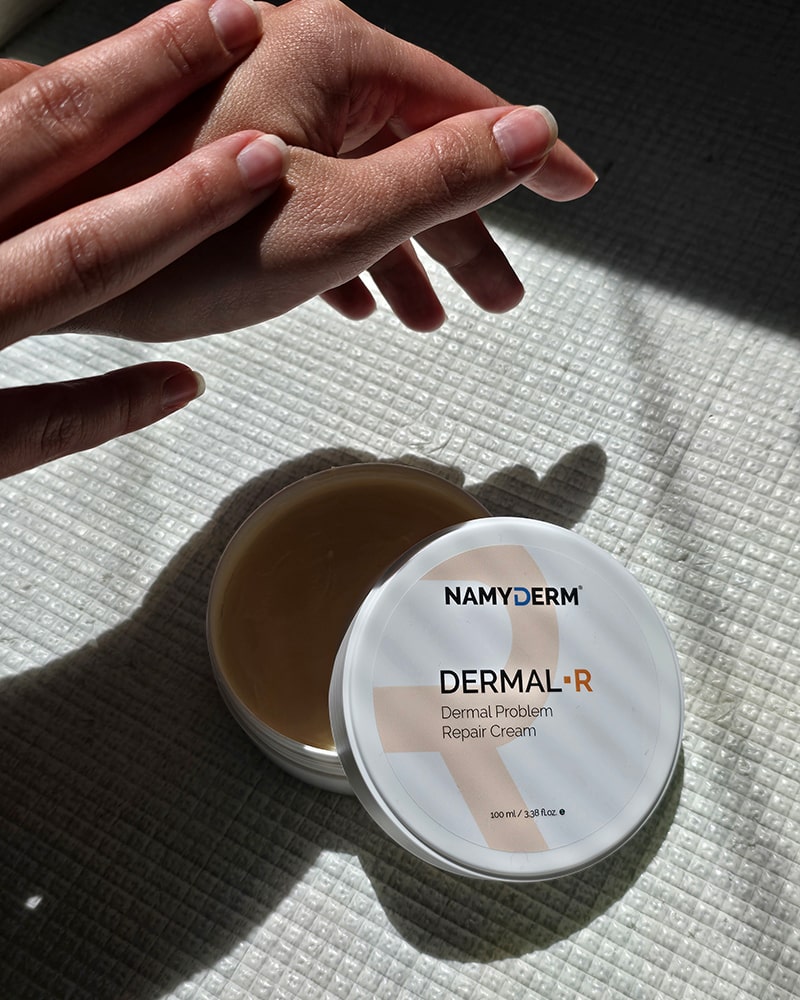 Dermal R | Popraskaná pokožka | Ochrana pred zimou