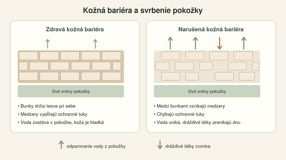 Kožná bariéra a svrbenie pokožky