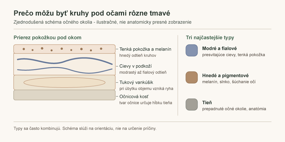 Prečo môžu byť kruhy pod očami rôzne tmavé